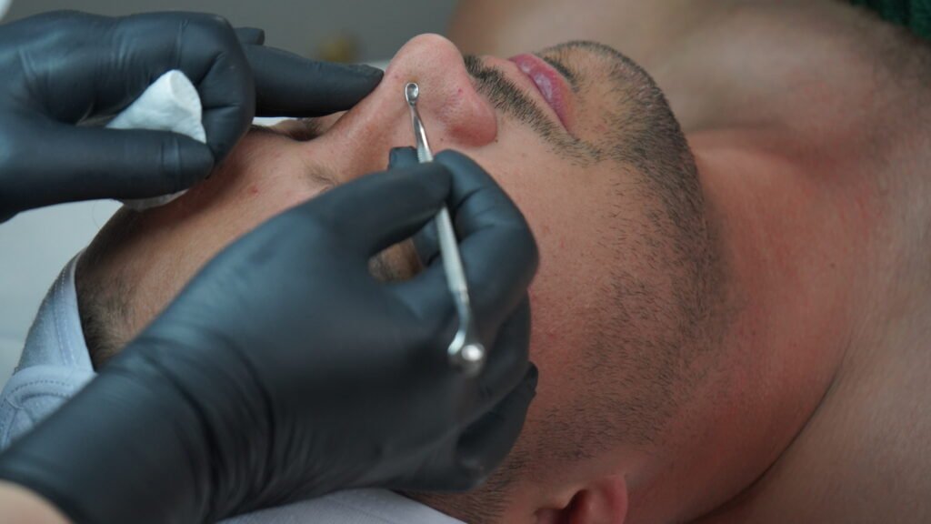 professional facial cleaning in Rocklin
