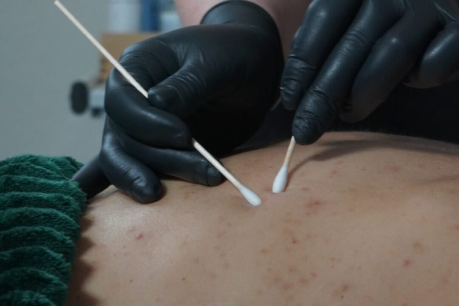 Back Treatment Near me