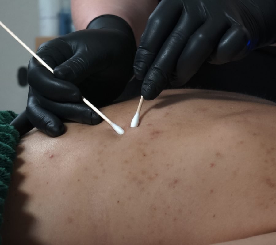 Back Treatment USA