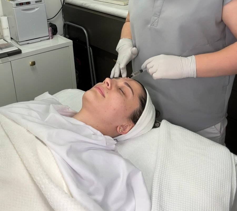 Chemical Peels
