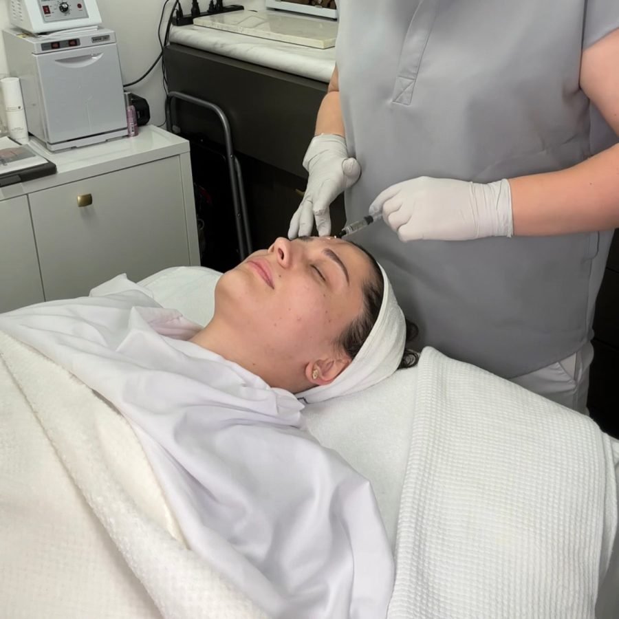 Chemical Peels Chemical Peels