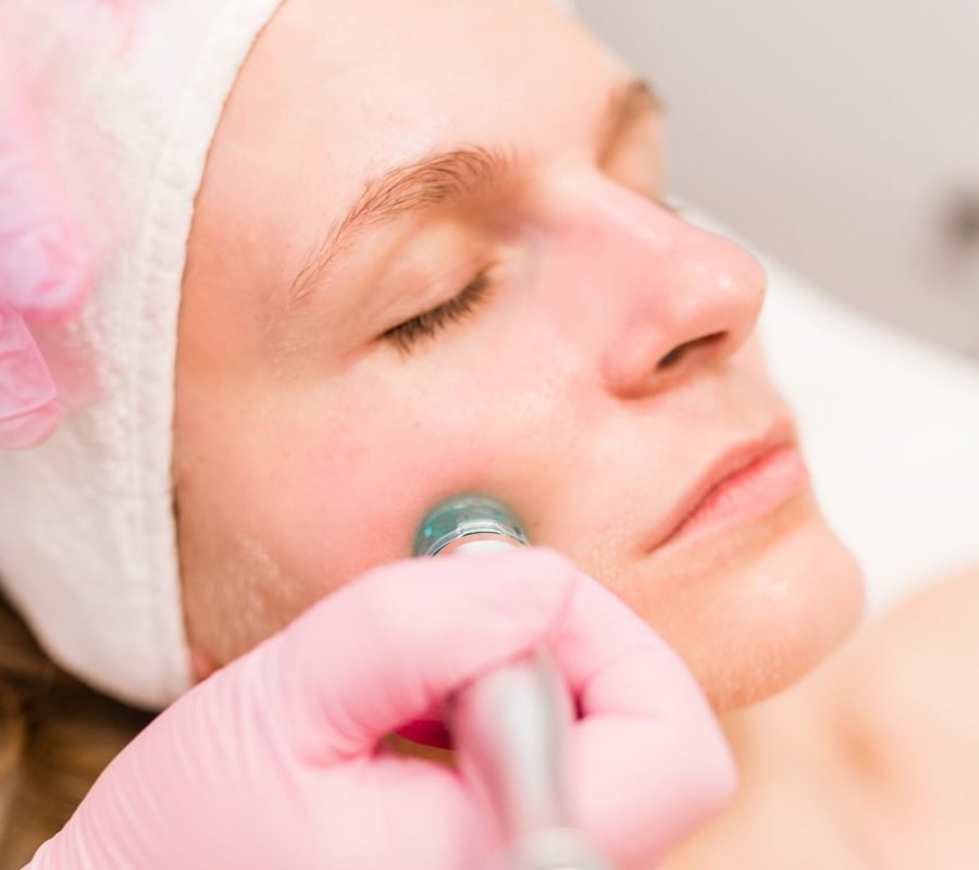 Hydra Peel